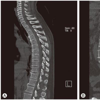 Diferența dintre CT și RMN - care este mai bine, computer sau imagistica prin rezonanță magnetică a articulațiilor RMN sau CT a articulațiilor șoldului, care este mai bună?